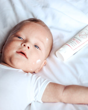 Most-common-skin-conditions-baby